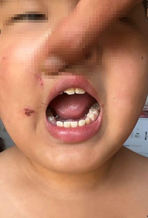 牙掉视频,揭秘牙齿脱落背后的惊人真相